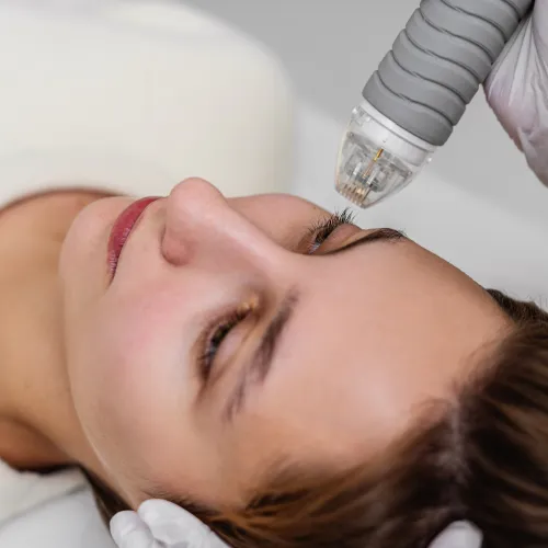 dermapen